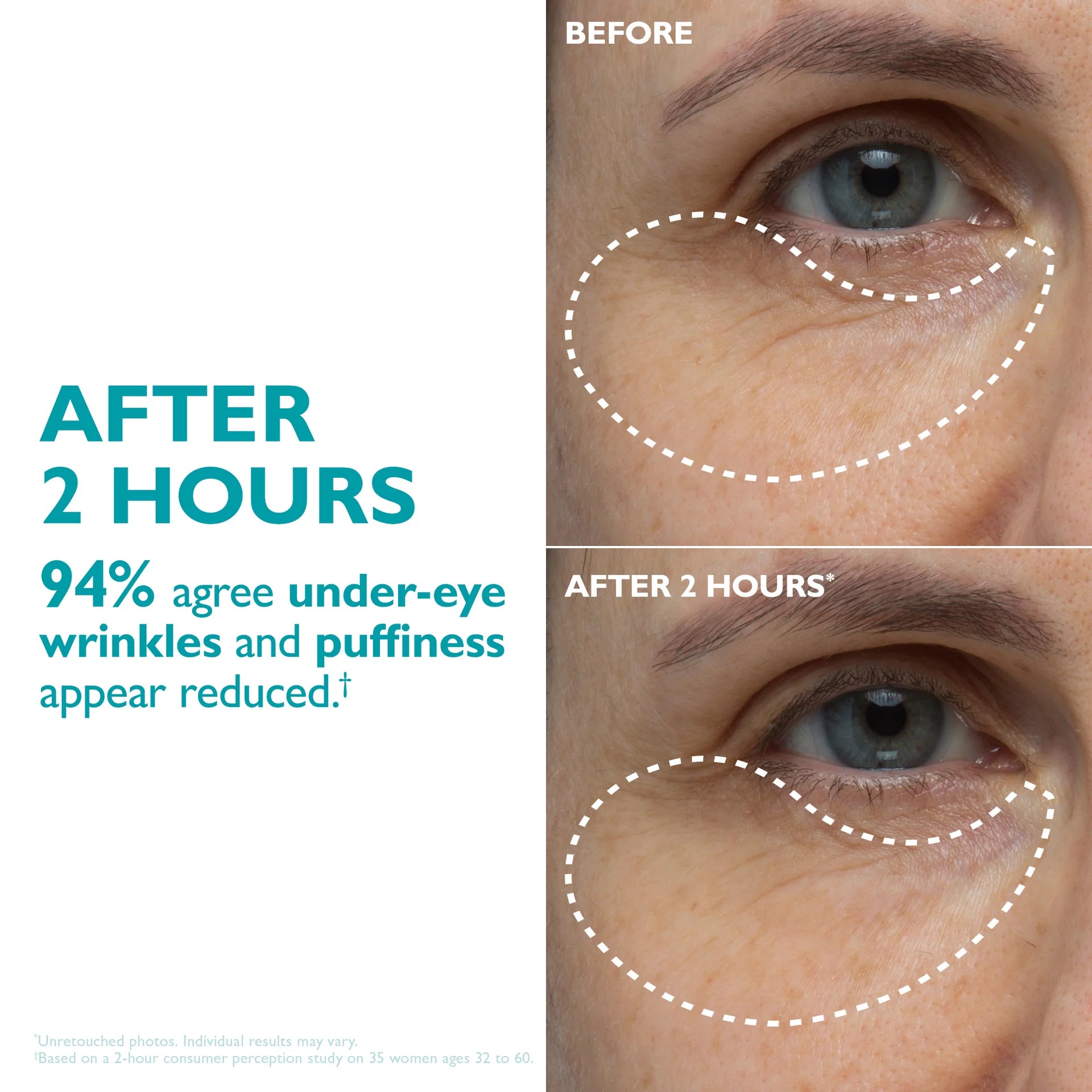 Peptide Infused Face & Eye Tape