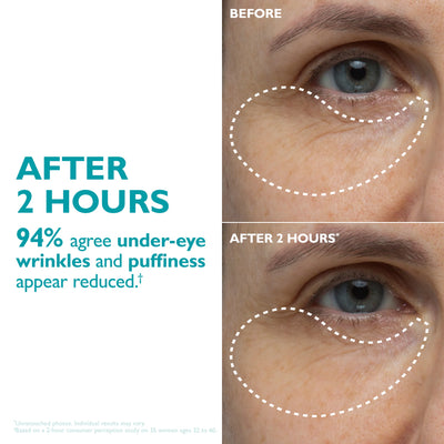 Peptide Infused Face & Eye Tape